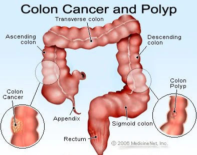 How To Cleanse The Colon Naturally